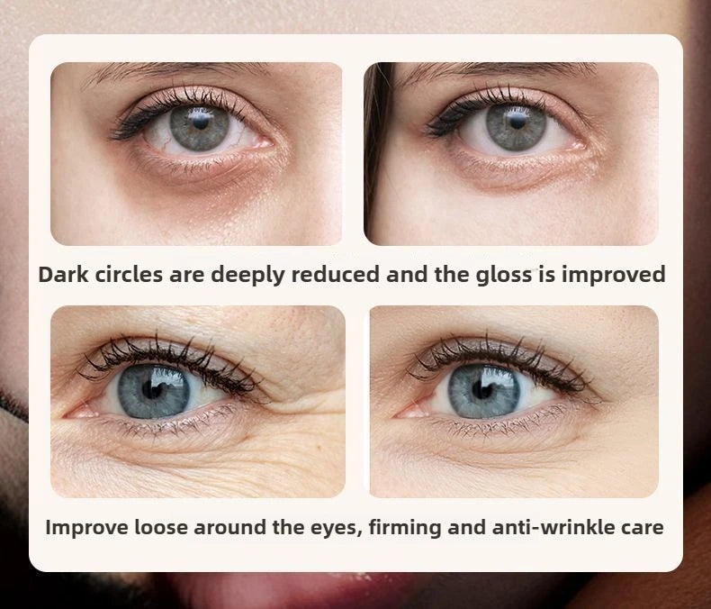 Anti-wrinkle and rejuvenating eye cream, moisturizing, nourishing, improving dullness, firming and removing eye bags