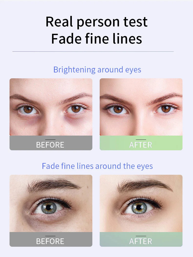 Anti Dark Circle Eye Serum Oil Retinol  Firming Skin Remove Eye Bag Fade Fine Line Whitening Brighten Eye Care Korea 2025