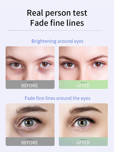 Anti Dark Circle Eye Serum Oil Retinol  Firming Skin Remove Eye Bag Fade Fine Line Whitening Brighten Eye Care Korea 2025