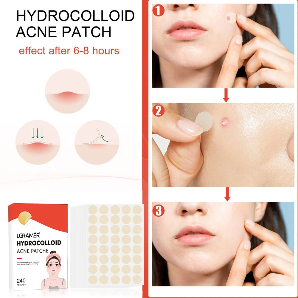 Repair Acne Patch Facial Skin Care Fade Blemishes Pimple Marks Closed Acne Blemishes Cover Acne Pimple Repair Patch