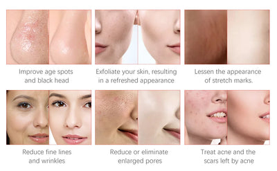 Professional Diamond Microdermabrasion Machine For Facial Peeling Skin Care Blackhead Removel Water Spray Exfoliation Machine