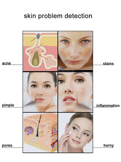 Magnifying Skin Analyzer Rechargeable Detector Hair Follicle Oil Moisture Pigment Tester Scalp/Face Skin Care Monitor 50X/200X