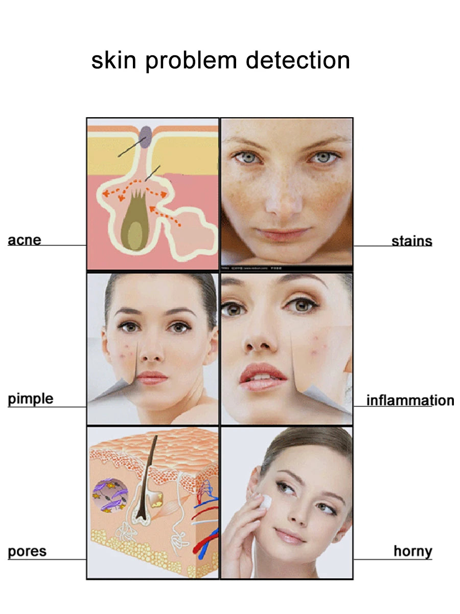 50/200X Charging Scalp Detector Digital Hair Skin Analyzer Microscope For Hair Follicle Testing and Skin Analysis Magnifier NEW