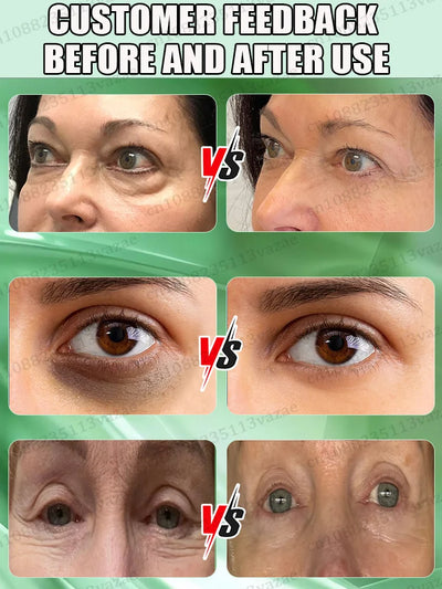 stay up late eye essence,keep your eyes forever young