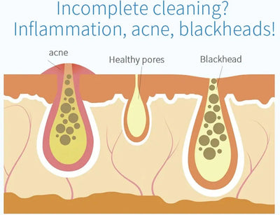 2IN1 Small BubbleVacuum Acne Pore Cleaner Blackhead Remover Skin Deep Cleaning Beauty Care Tools Moisturizing Beauty Instrument