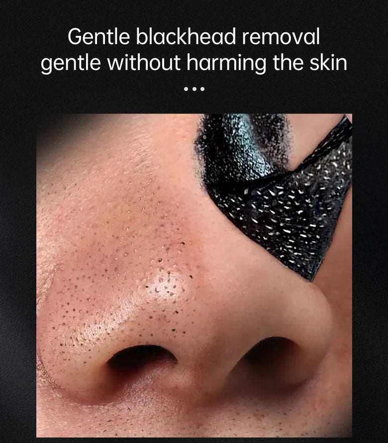 Black Head Remover Face Mask Bamboo Charcoal Black Dot T-zone Deep Cleaning for Women Men Blackhead Facial Skin Care Products
