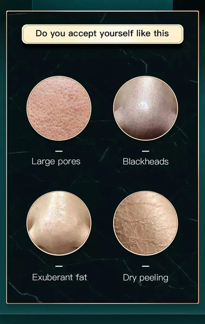 2IN1 Small BubbleVacuum Acne Pore Cleaner Blackhead Remover Skin Deep Cleaning Beauty Care Tools Moisturizing Beauty Instrument