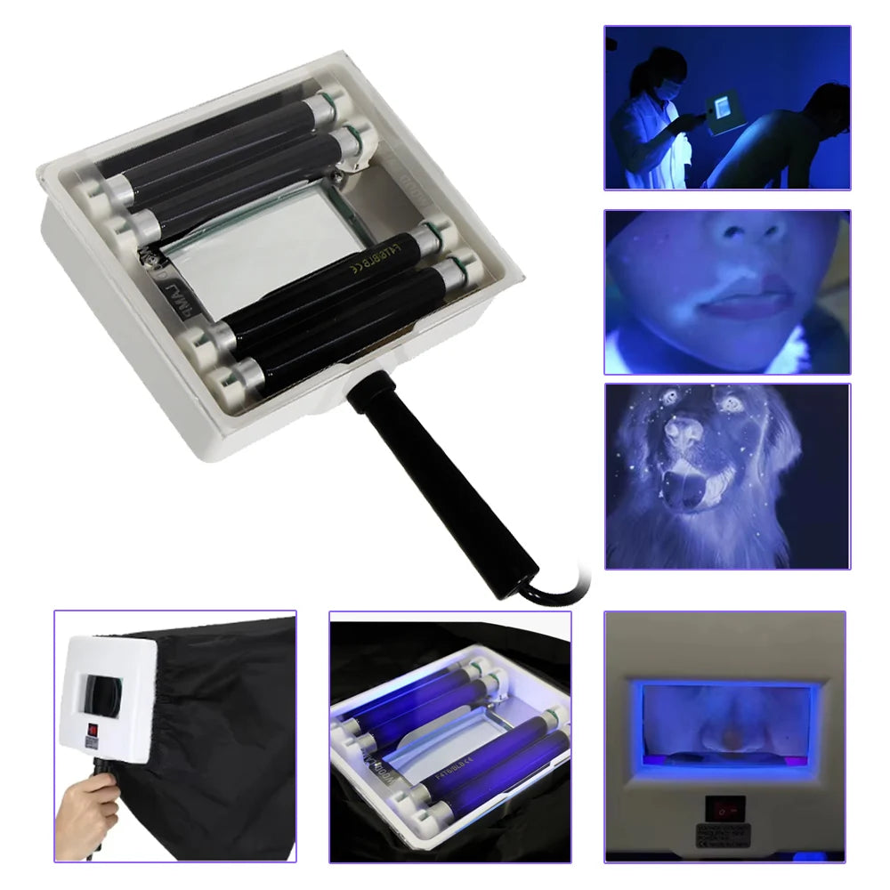 AOKO Wood UV Lamp Skin Appraisal Analyzer Facial Skin Vitiligo Testing Examination Magnifying Machine Greyness Skin Tinea