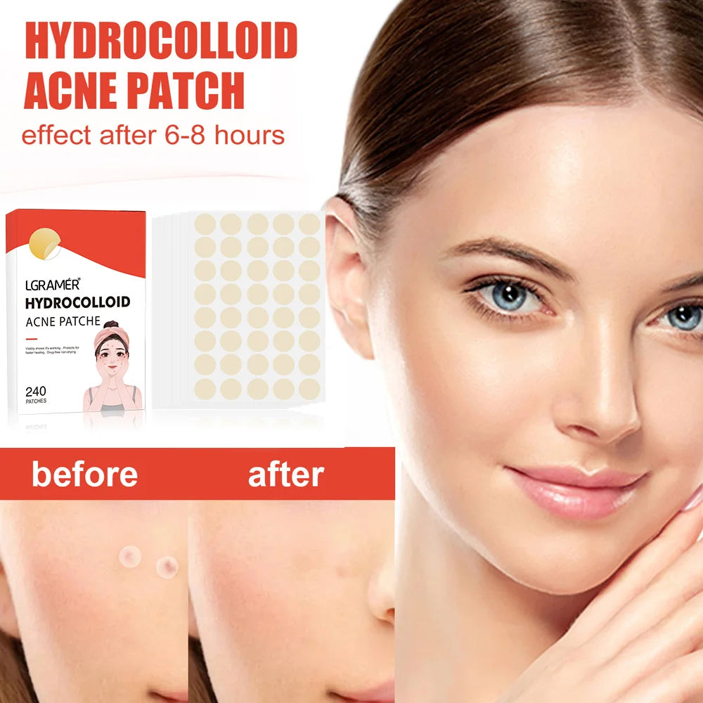 Repair Acne Patch Facial Skin Care Fade Blemishes Pimple Marks Closed Acne Blemishes Cover Acne Pimple Repair Patch