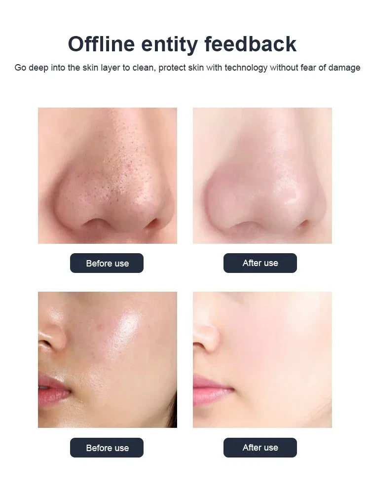 New Arrival! 10IN1 Water Oxygen Jet Peel Hydro Beauty Skin Cleansing Hydro facial Machine Facial Machine Water Aqua Peeling