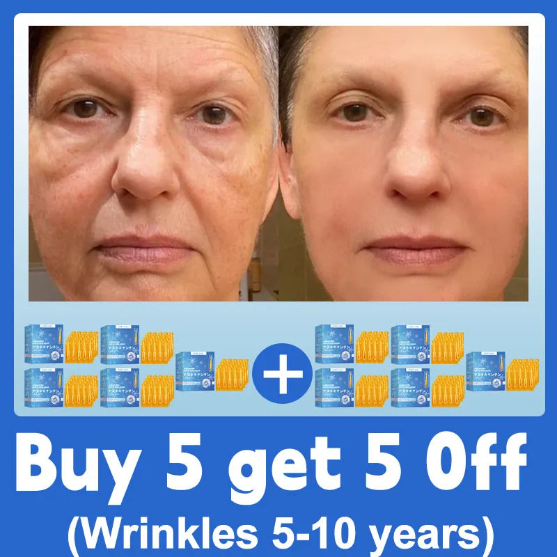 20 ʏᴇᴀʀs ʏᴏᴜɴɢᴇʀ! Aɴᴛɪ-ᴡʀɪɴᴋʟᴇ, ғɪʀᴍɪɴɢ, ʟɪɢʜᴛ ʟɪɴᴇs ʀᴇᴘᴀɪʀ