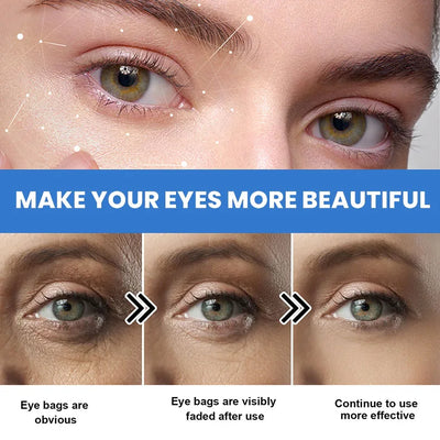 Instant Eye Bag Remove Eye Cream Anti Fat Particles Dark Circles Puffiness Fade Fine Lines Lift Brighten Korean Beauty Eye Care