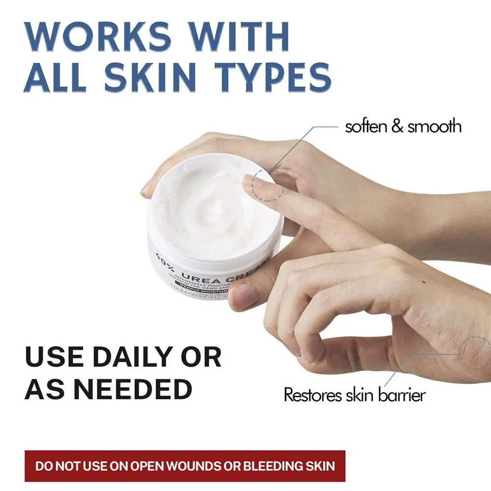 1pcs 150g Urea Cream 40% Urea Cream Anti-dry Cracking Moisturizing Hydration Hand and Foot Cream