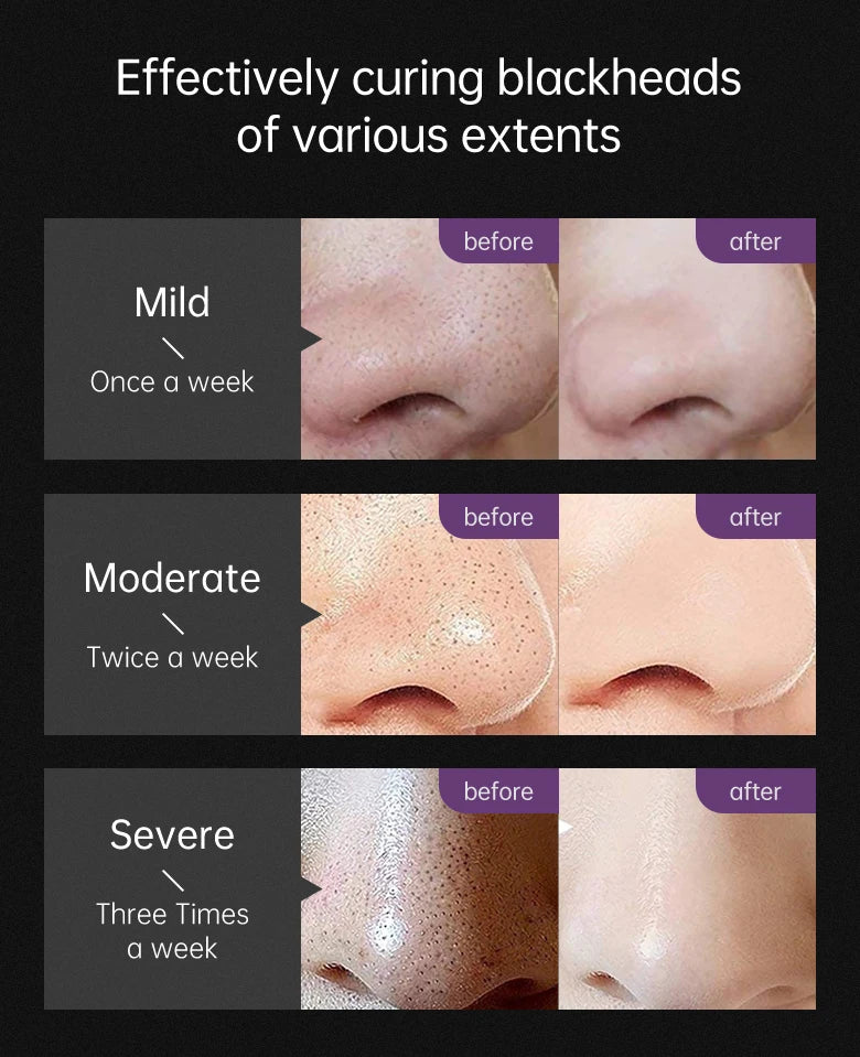 Black Head Remover Face Mask Bamboo Charcoal Black Dot T-zone Deep Cleaning for Women Men Blackhead Facial Skin Care Products