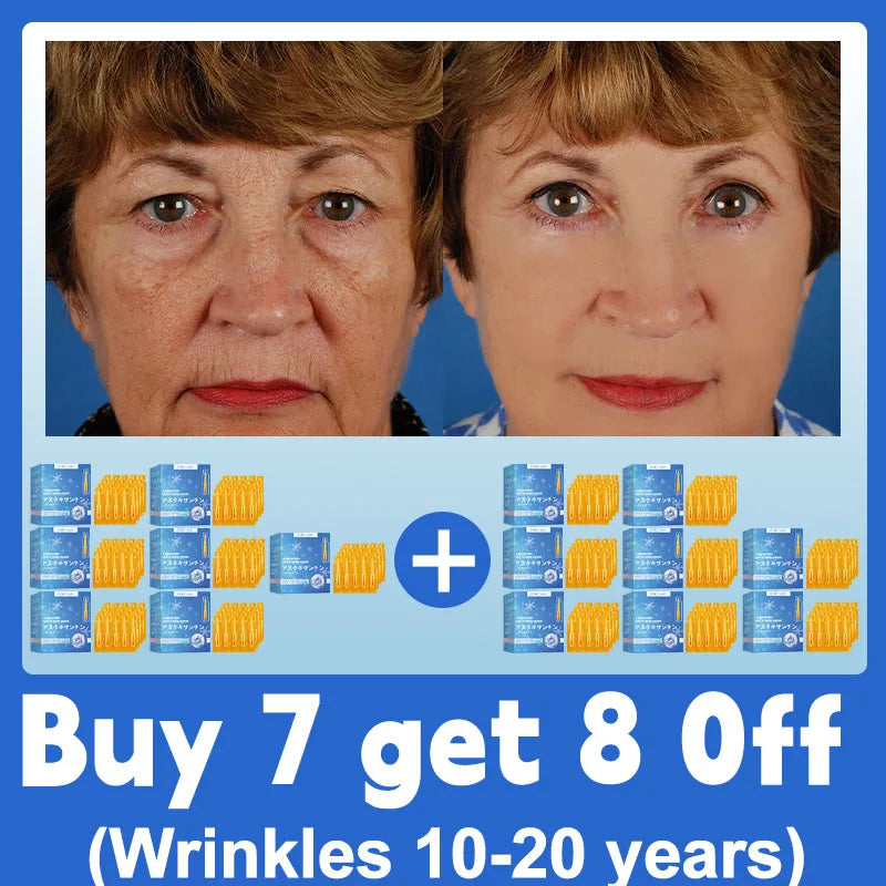 20 ʏᴇᴀʀs ʏᴏᴜɴɢᴇʀ! Aɴᴛɪ-ᴡʀɪɴᴋʟᴇ, ғɪʀᴍɪɴɢ, ʟɪɢʜᴛ ʟɪɴᴇs ʀᴇᴘᴀɪʀ