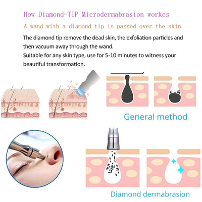 Microdermabrasion Facial Diamond Dermabrasion Machine Portable Blackhead Acne Pore Cleaning Beauty Device Rejuvenation Peeling