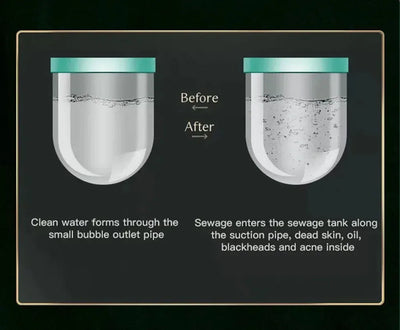 2IN1 Small BubbleVacuum Acne Pore Cleaner Blackhead Remover Skin Deep Cleaning Beauty Care Tools Moisturizing Beauty Instrument