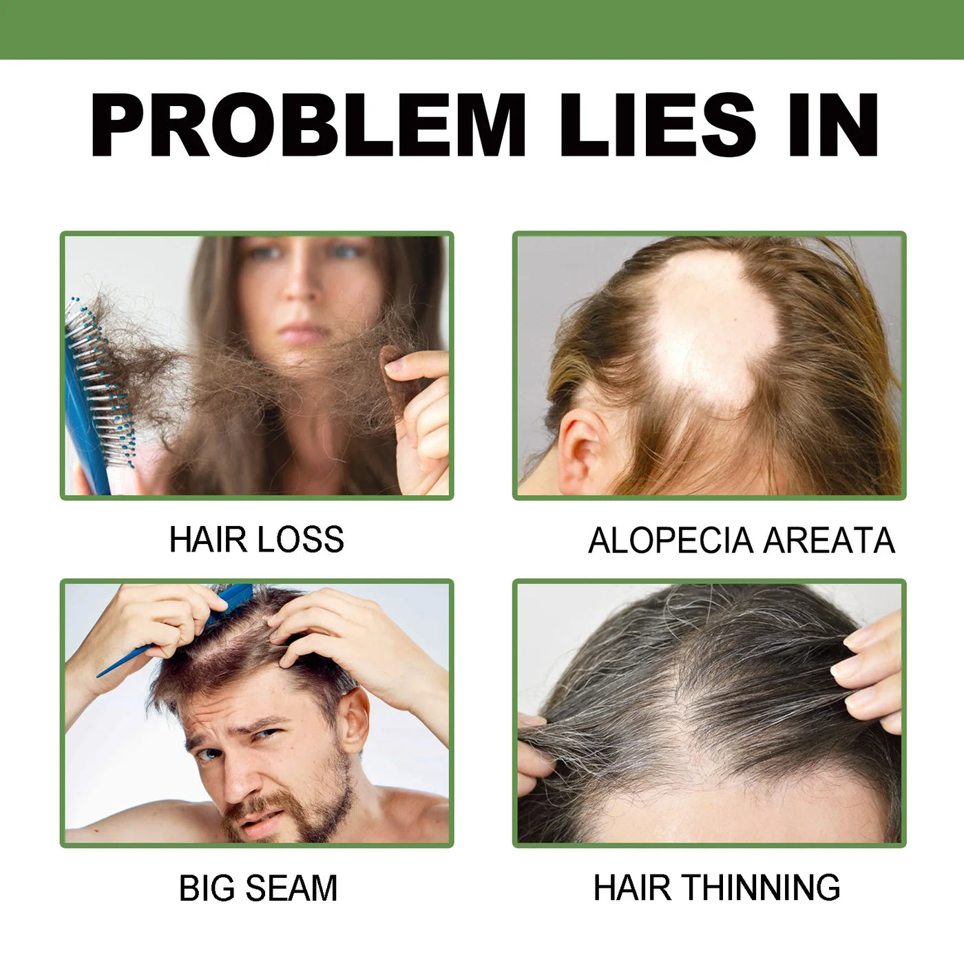 Hair Root Nutrient Peptide Protein Shampoo, Keratin and Biotin, 8.82 Oz, Deep Care for Dry, Frizzy and Damaged Hair, Moisturizing and Smoothing Formula, Suitable for Men and Women