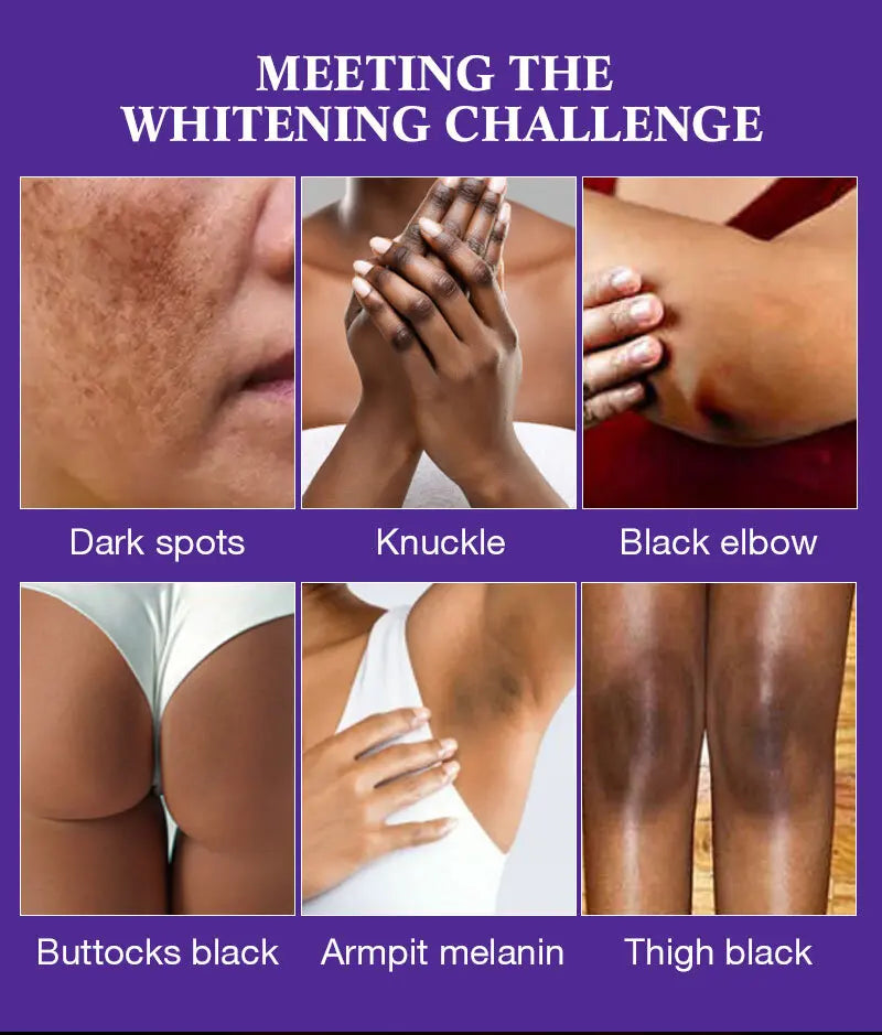 Papaya Kojic Acid Body Oil Deeply nourishes skin moisturizes fades dark spots evens tone absorbs fast enhances natural glow