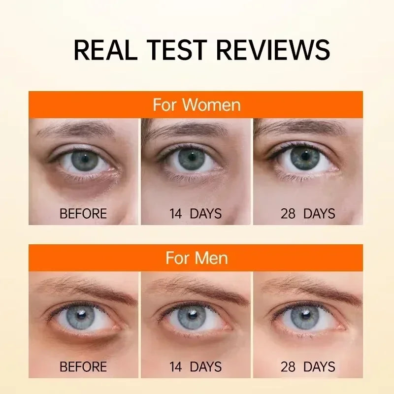 Anti Dark Circle Eye Serum Oil Retinol  Firming Skin Remove Eye Bag Fade Fine Line Whitening Brighten Eye Care Korea 2025