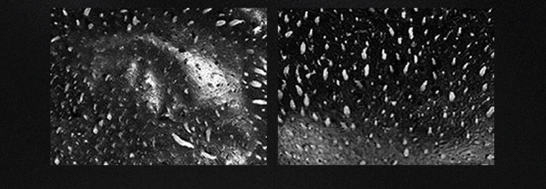 Black Head Remover Face Mask Bamboo Charcoal Black Dot T-zone Deep Cleaning for Women Men Blackhead Facial Skin Care Products