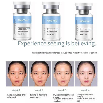 Polypeptide Placenta Freeze-dried Powder Essence Repair Facial Hydrating Nourishing Pore Shrinking Skin Rejuvenate Skin Care