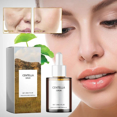 Centella Asiatica Face Serum Nourish Dry Skin Smoothing Rejuvenation Skin Brightening Whitening Cream Facial Moisturizer Korean