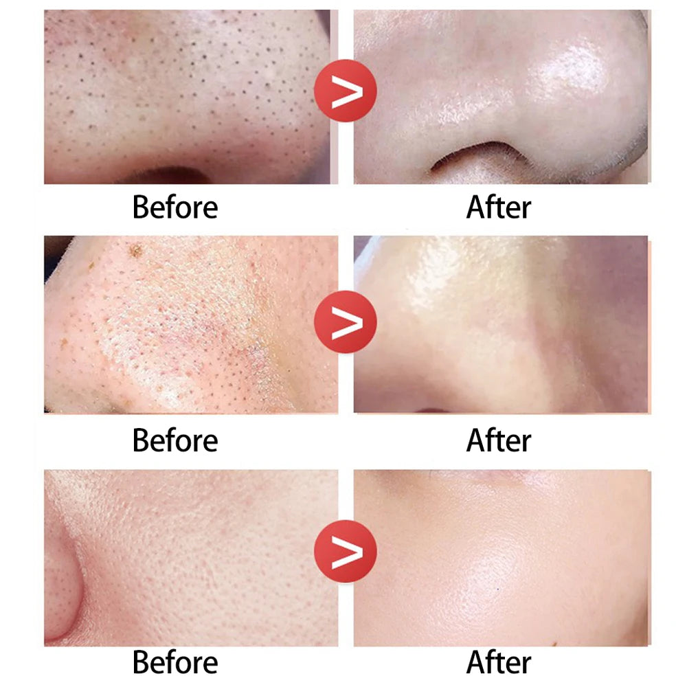 Peel Off Nose Blackhead Remover Mask Deep Cleansing Shrink Pore Acne Treatment Strips Nose Patches Face Skin Care Beauty Tools