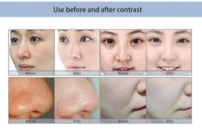 Aqua Peeling Solution Skin Clean Essence Product Serum for Hydrogen Facial Machine Face Deep Cleaning (50ml=800ml)