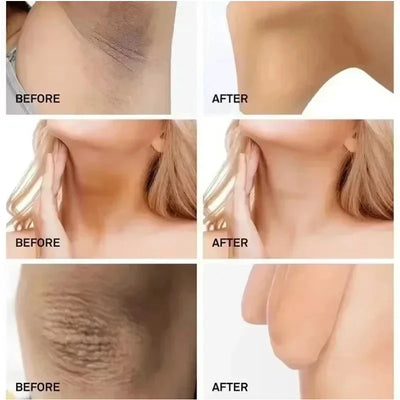 Whitening Cream Private Parts Underarm Bleaching Serum Whiten Butt Knee Brighten Inner Thigh Intimate Parts Dark Remove Melanin