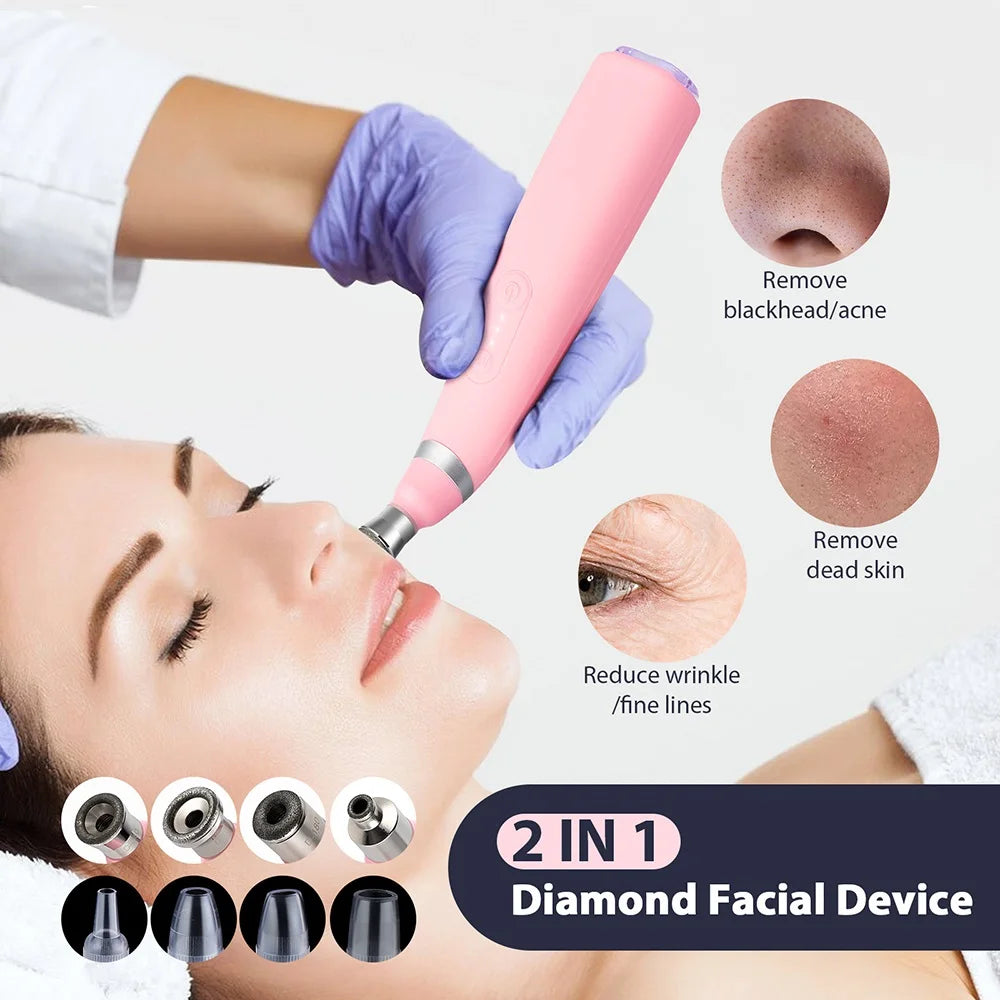 Portable Diamond Microdermabrasion Machine Facial Peeling Device Exfoliation Vacuum Blackhead Remover With 4 Diamond Peeling Tip