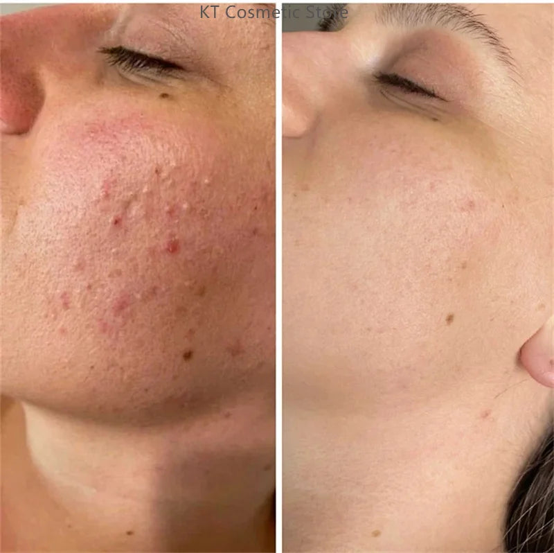 Black White Rice Peel Shot Glow Rice Ampoule Duo Exfoliate Dead Skin Closed Pimples Moisturize Brighten Smooth Pores Care Korea