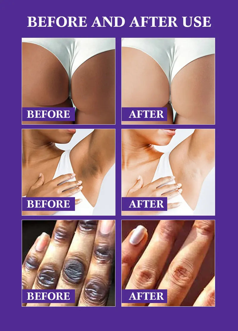 Papaya Kojic Acid Body Oil Deeply nourishes skin moisturizes fades dark spots evens tone absorbs fast enhances natural glow