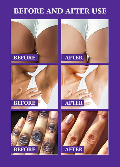 Papaya Kojic Acid Body Oil Deeply nourishes skin moisturizes fades dark spots evens tone absorbs fast enhances natural glow