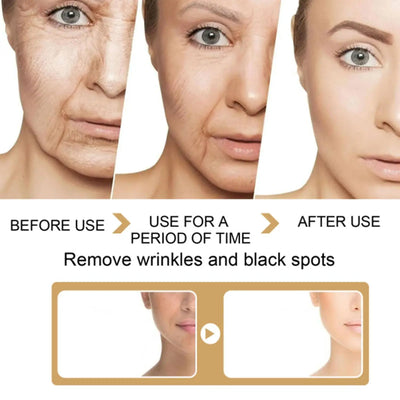 Ginger Turmeric Face Essence Oil Black Spots Remove Repair Aging Whitening Serum Skin Removal Moisturizing Wrinkles Oil Ant