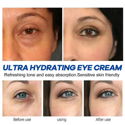 Instant Eye Bag Remove Eye Cream Anti Fat Particles Dark Circles Puffiness Fade Fine Lines Lift Brighten Korean Beauty Eye Care