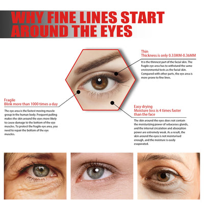 Eye Lifting Serum Anti Dark Circles Puffiness Reduce Fine Lines Wrinkle Firming Nourishing Brightening Eye Bags Remover Essence