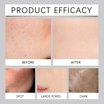 Enzyme Face Wash Powder 75g Gentle Exfoliating Cleanser for Sensitive Skin Removes Dirt Brightens Skin Travel Friendly Formula