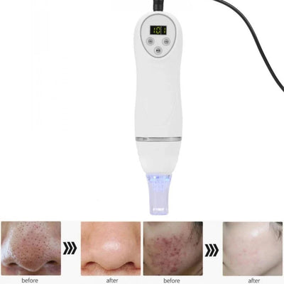 Home Use Blackhead Acne Removal Beauty Device Microdermabrasion Diamond Peeling Vacuum Machine Facial Skin Care Scar Faded Set