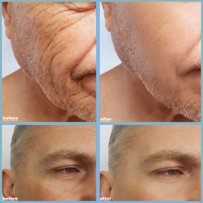 Men Retinol Eye Bags Remover Cream