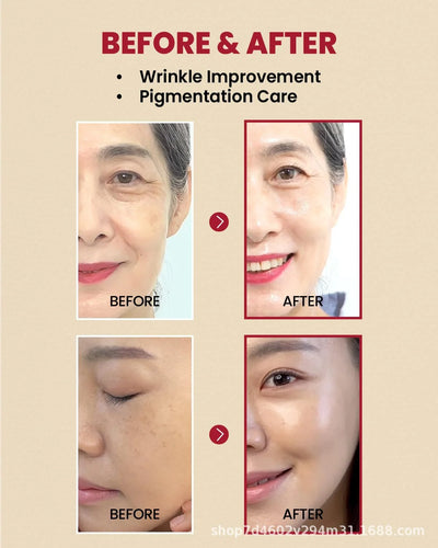 Seoul 1988 Anti-Aging Trio: 4% Retinal Eye Cream + 2% Retinal Serum w/ Black Ginseng for Wrinkles & Brightening,Korean Skincare