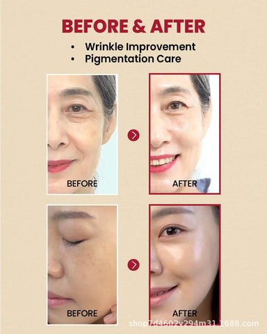 Seoul 1988 Anti-Aging Trio: 4% Retinal Eye Cream + 2% Retinal Serum w/ Black Ginseng for Wrinkles & Brightening,Korean Skincare