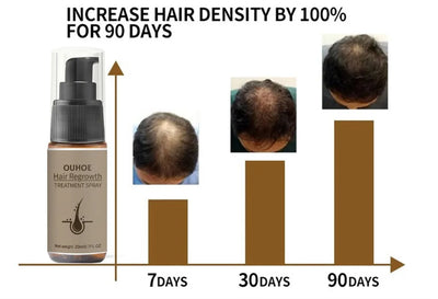 Hair Growth Serum Spray Ginger Anti Hair Loss Treatment Products Repair Nourish hair Roots Fast Regrowth Men Women