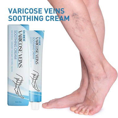 Relieve Vasculitis Cream Phlebitis Worm Spider Legs Vessel Pain Treatment Soothing Reduce Swelling Varicose Vein Relief Ointment