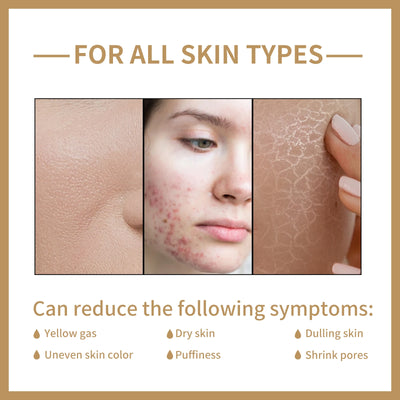 Rice Moisturizing Toner Repairs Damaged Skin Firms Tighter Skin Softens Lines And Wrinkles Shrinks Pores And Brightens Skin Tone