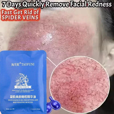 Fast Repair Facial Redness Essential oil Soothing Red Blood Rosacea Improve Sensitive Skin Dryness Moisturizing Korean Cosmetics