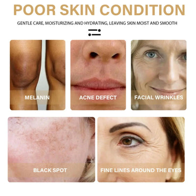 Ginger Turmeric Face Essence Oil Black Spots Remove Repair Aging Whitening Serum Skin Removal Moisturizing Wrinkles Oil Ant