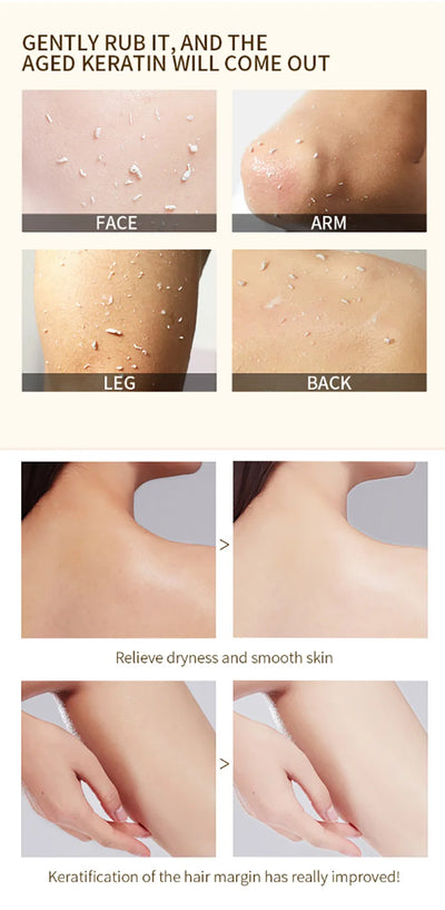 Facial exfoliating gel, moisturizing, brightening, nourishing, face cream, skin beauty care gel