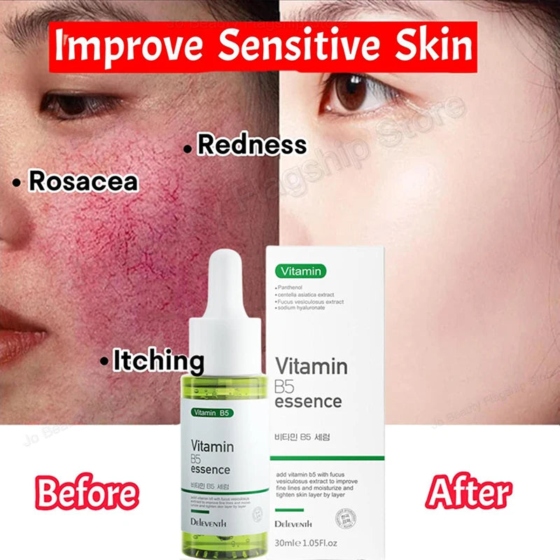 7 Day Repair Redness Serum Sooth Itching Sensitive Skin Improve Rosacea Shrink Pore Smooth Nourish Facial Skin Korean Cosmetics