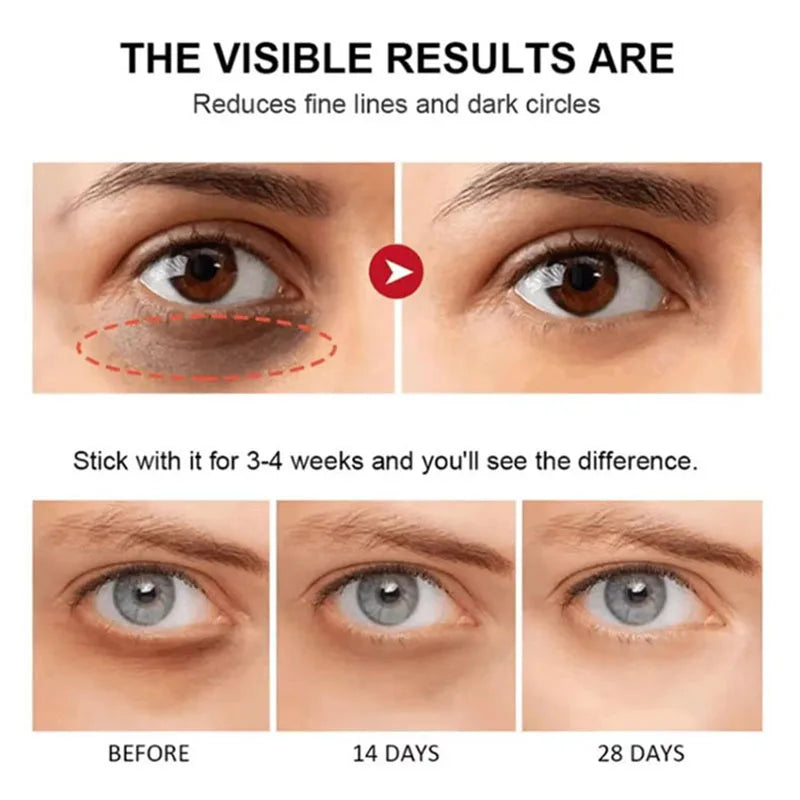 Instant Eye Bag Remove Eye Cream Anti Fat Particles Dark Circles Puffiness Fade Fine Lines Lift Brighten Korean Beauty Eye Care